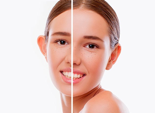 chirurgie-oreilles-tunisie